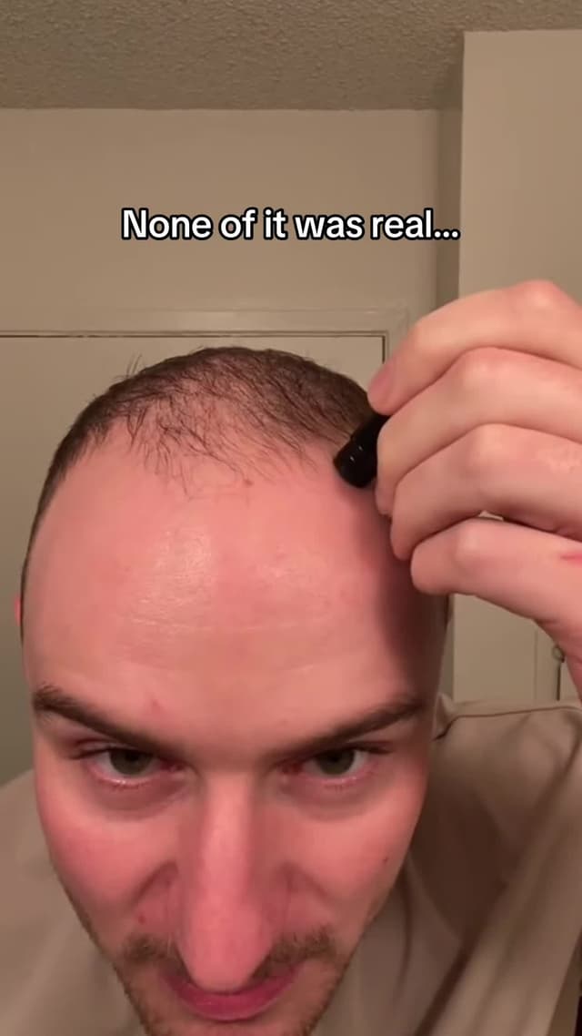 Like it never even happened #hair #hairtransformation #hairgrowth 